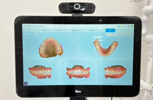 口腔内スキャナー