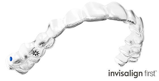 インビザライン・ファースト